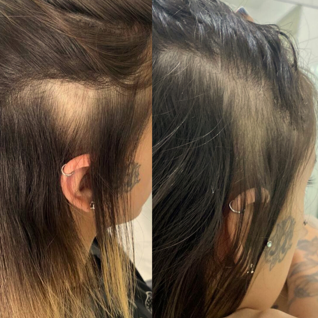 Kit ampolas de tratamento BiaBellaBooM