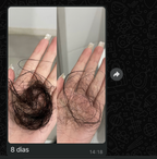 Kit 90 Dias SOS Queda - Ampolas para Tratamento Intensivo Capilar