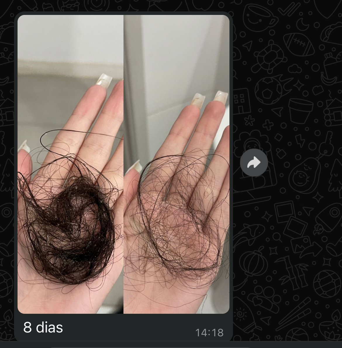 Kit 90 Dias SOS Queda - Ampolas para Tratamento Intensivo Capilar