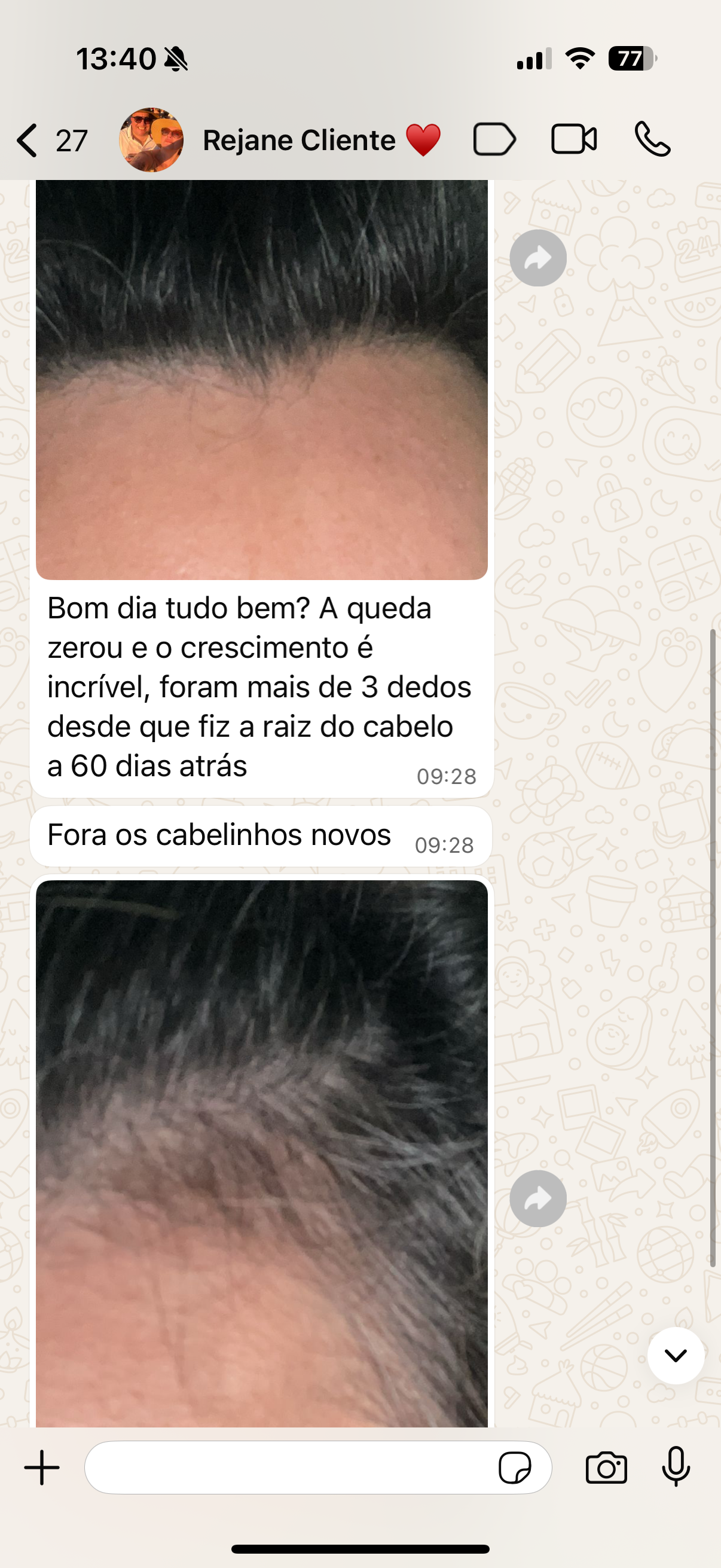 Ampola anti queda de Shampoo- 5 ml