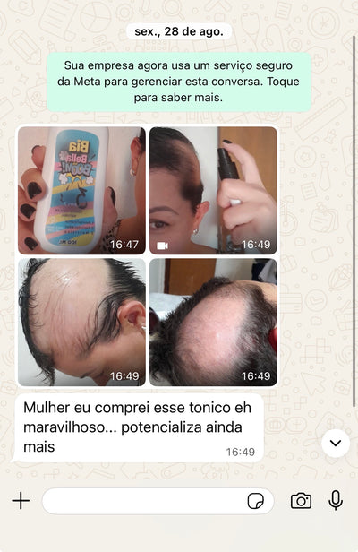 DEPOIS
